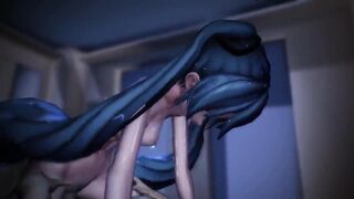 Miku need some
