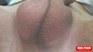 Scrotum with Eggs Moves Fast