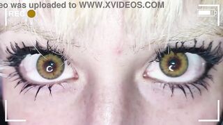 Green Blackspot