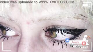Green Blackspot